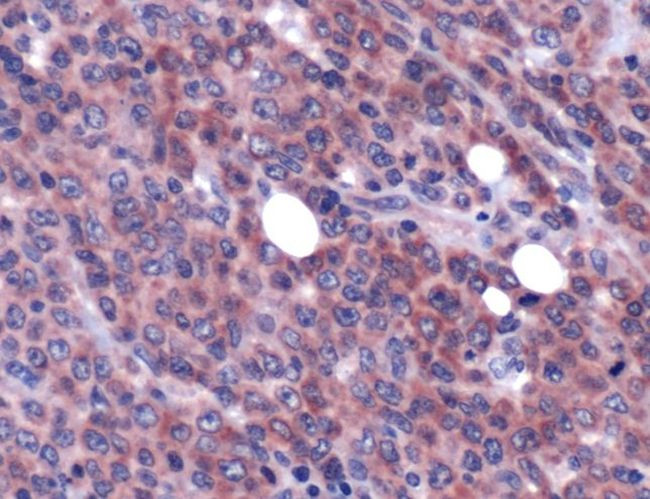 MALT1 Antibody in Immunohistochemistry (IHC)