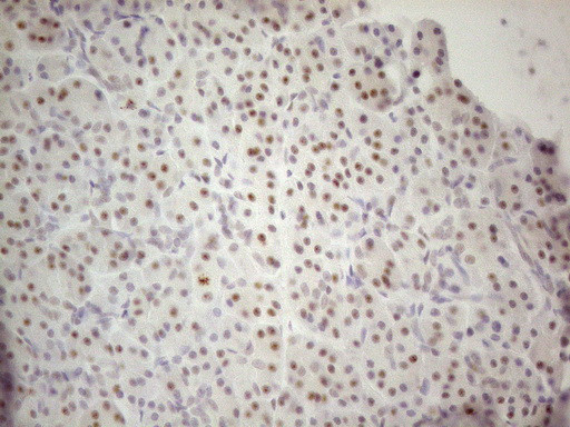 MALT1 Antibody in Immunohistochemistry (Paraffin) (IHC (P))