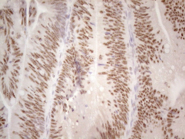 MALT1 Antibody in Immunohistochemistry (Paraffin) (IHC (P))