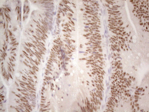 MALT1 Antibody in Immunohistochemistry (Paraffin) (IHC (P))