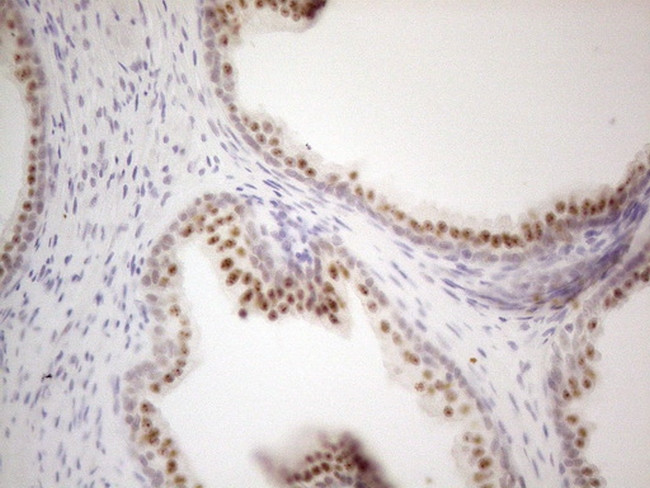 MALT1 Antibody in Immunohistochemistry (Paraffin) (IHC (P))