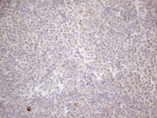 MALT1 Antibody in Immunohistochemistry (Paraffin) (IHC (P))