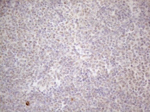 MALT1 Antibody in Immunohistochemistry (Paraffin) (IHC (P))