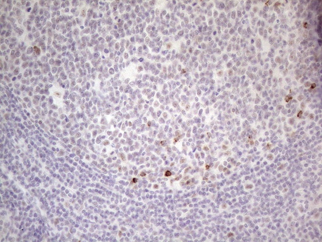 MALT1 Antibody in Immunohistochemistry (Paraffin) (IHC (P))