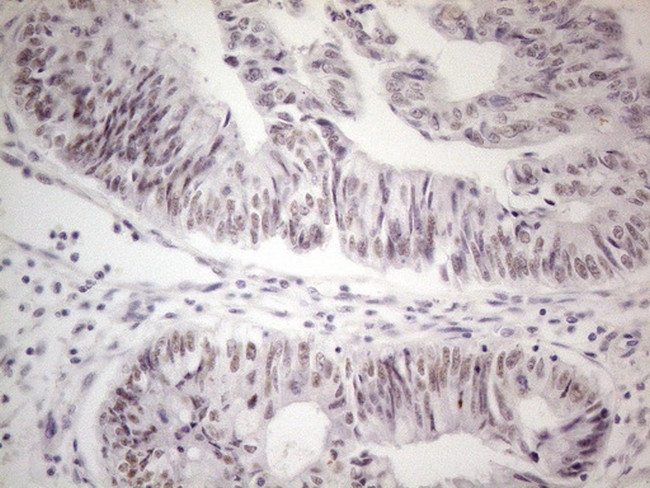 MALT1 Antibody in Immunohistochemistry (Paraffin) (IHC (P))