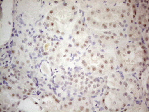 MALT1 Antibody in Immunohistochemistry (Paraffin) (IHC (P))