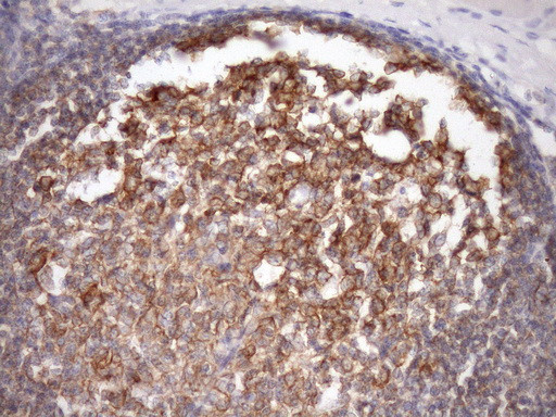 MALT1 Antibody in Immunohistochemistry (Paraffin) (IHC (P))