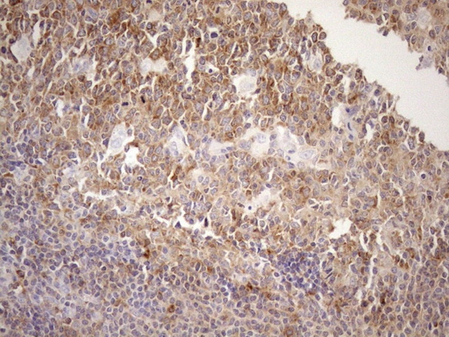 MALT1 Antibody in Immunohistochemistry (Paraffin) (IHC (P))