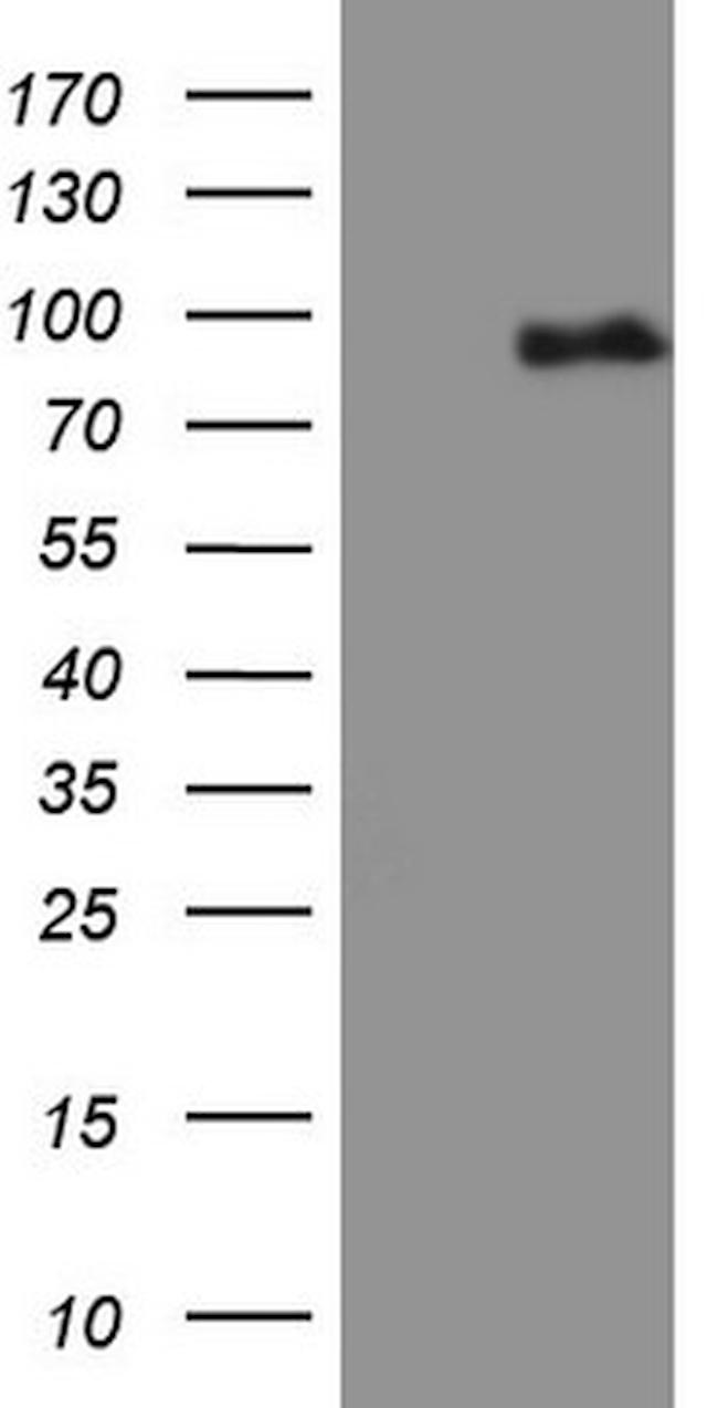 MALT1 Antibody in Western Blot (WB)