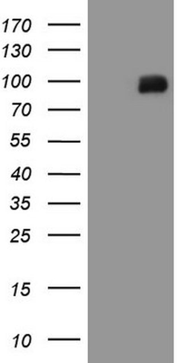 MALT1 Antibody in Western Blot (WB)