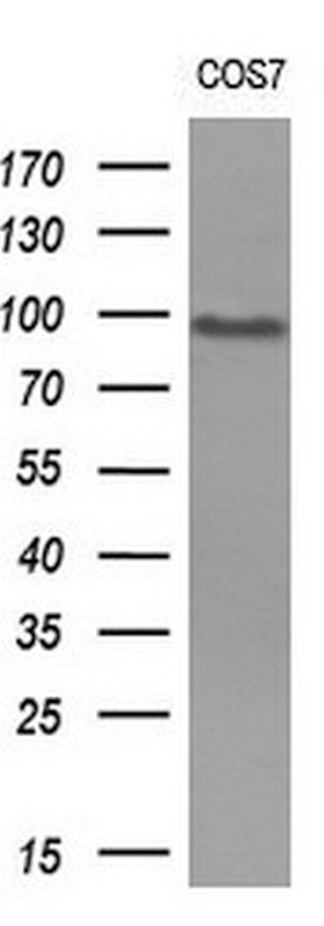 MALT1 Antibody in Western Blot (WB)