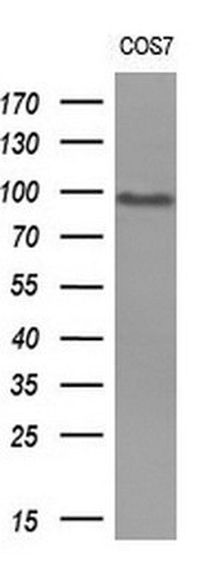 MALT1 Antibody in Western Blot (WB)