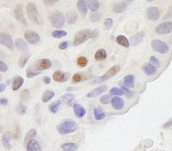 MAML2 Antibody in Immunohistochemistry (IHC)