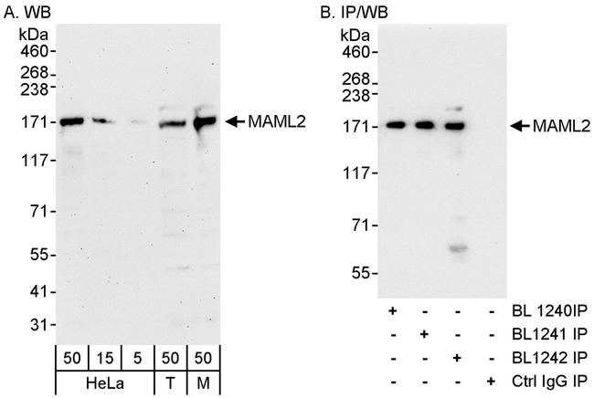 MAML2 Antibody in Western Blot (WB)