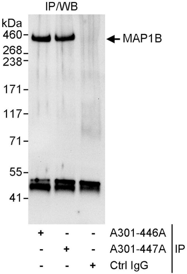 MAP1B Antibody in Immunoprecipitation (IP)