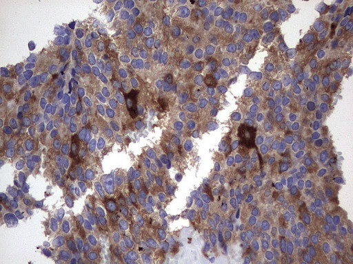 MAP1LC3A Antibody in Immunohistochemistry (Paraffin) (IHC (P))