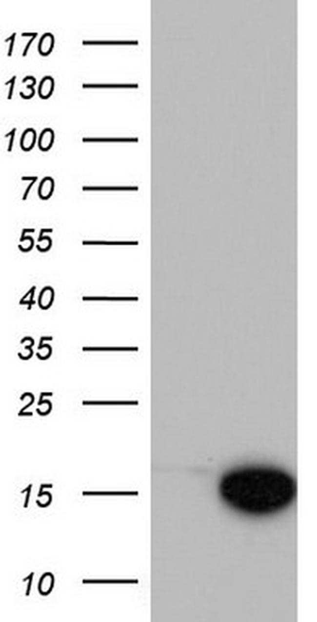 MAP1LC3A Antibody in Western Blot (WB)