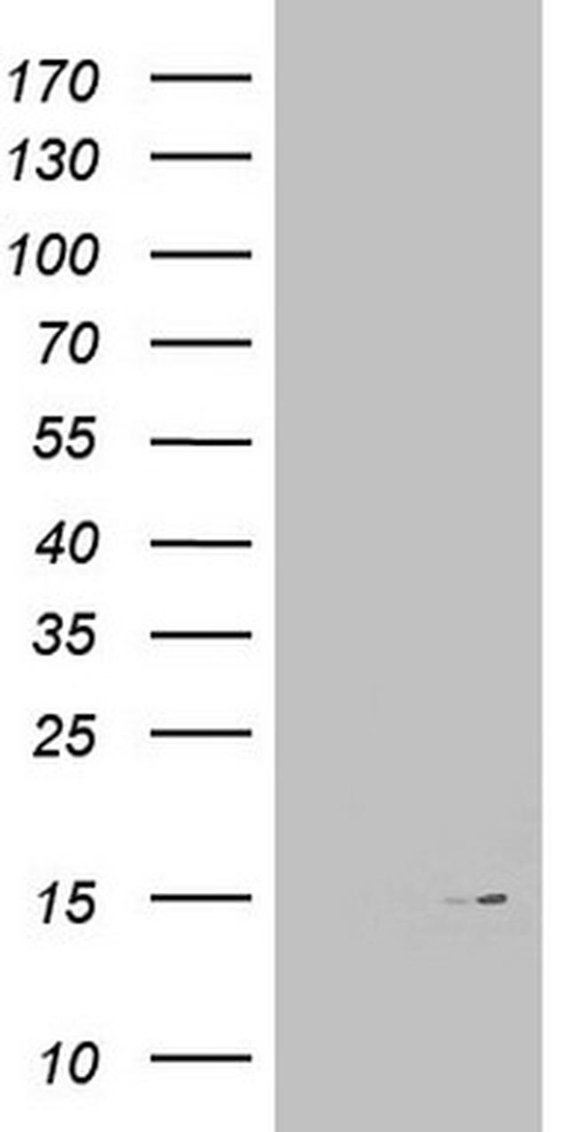 MAP1LC3A Antibody in Western Blot (WB)