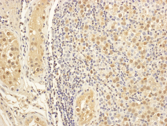 MAP1S Antibody in Immunohistochemistry (IHC)