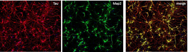 MAP2 Antibody in Immunocytochemistry (ICC/IF)