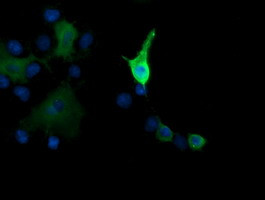 MAP2K1 Antibody in Immunocytochemistry (ICC/IF)