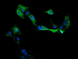 MAP2K1 Antibody in Immunocytochemistry (ICC/IF)