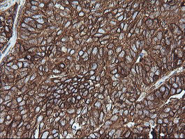 MAP2K1 Antibody in Immunohistochemistry (Paraffin) (IHC (P))