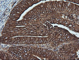 MAP2K1 Antibody in Immunohistochemistry (Paraffin) (IHC (P))