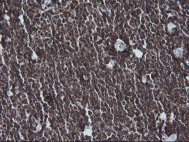 MAP2K1 Antibody in Immunohistochemistry (Paraffin) (IHC (P))