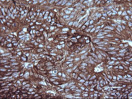 MAP2K1 Antibody in Immunohistochemistry (Paraffin) (IHC (P))