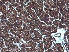 MAP2K1 Antibody in Immunohistochemistry (Paraffin) (IHC (P))