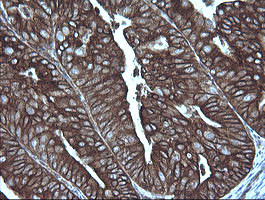 MAP2K1 Antibody in Immunohistochemistry (Paraffin) (IHC (P))