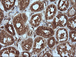 MAP2K1 Antibody in Immunohistochemistry (Paraffin) (IHC (P))