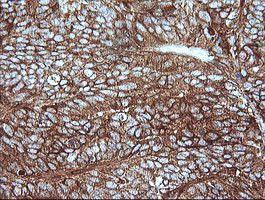 MAP2K1 Antibody in Immunohistochemistry (Paraffin) (IHC (P))