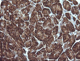 MAP2K1 Antibody in Immunohistochemistry (Paraffin) (IHC (P))