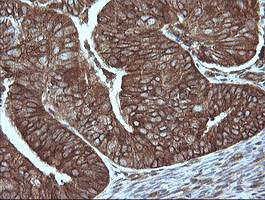 MAP2K1 Antibody in Immunohistochemistry (Paraffin) (IHC (P))