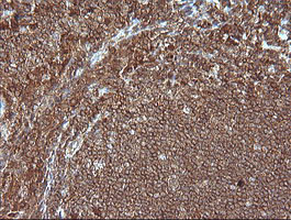 MAP2K1 Antibody in Immunohistochemistry (Paraffin) (IHC (P))