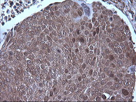 MAP2K1 Antibody in Immunohistochemistry (Paraffin) (IHC (P))