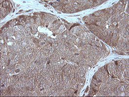 MAP2K1 Antibody in Immunohistochemistry (Paraffin) (IHC (P))