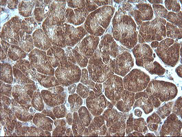 MAP2K1 Antibody in Immunohistochemistry (Paraffin) (IHC (P))