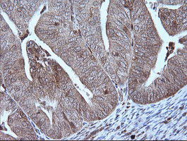 MAP2K1 Antibody in Immunohistochemistry (Paraffin) (IHC (P))