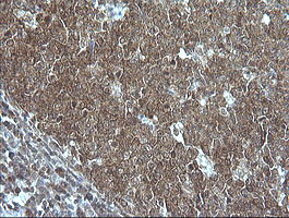 MAP2K1 Antibody in Immunohistochemistry (Paraffin) (IHC (P))