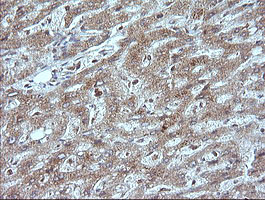 MAP2K1 Antibody in Immunohistochemistry (Paraffin) (IHC (P))