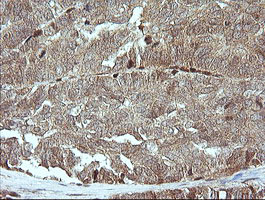 MAP2K1 Antibody in Immunohistochemistry (Paraffin) (IHC (P))