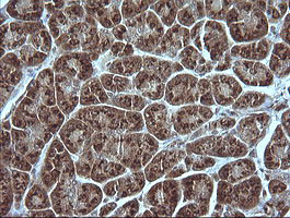 MAP2K1 Antibody in Immunohistochemistry (Paraffin) (IHC (P))