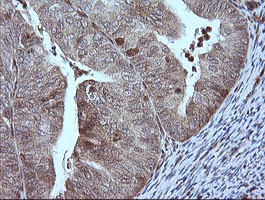 MAP2K1 Antibody in Immunohistochemistry (Paraffin) (IHC (P))