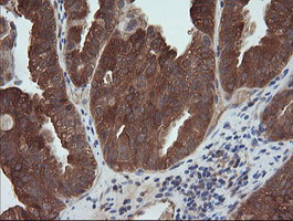 MAP2K1 Antibody in Immunohistochemistry (Paraffin) (IHC (P))