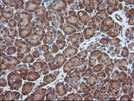 MAP2K1 Antibody in Immunohistochemistry (Paraffin) (IHC (P))