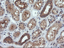 MAP2K1 Antibody in Immunohistochemistry (Paraffin) (IHC (P))