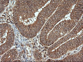 MAP2K1 Antibody in Immunohistochemistry (Paraffin) (IHC (P))